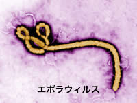 エボラウイルス